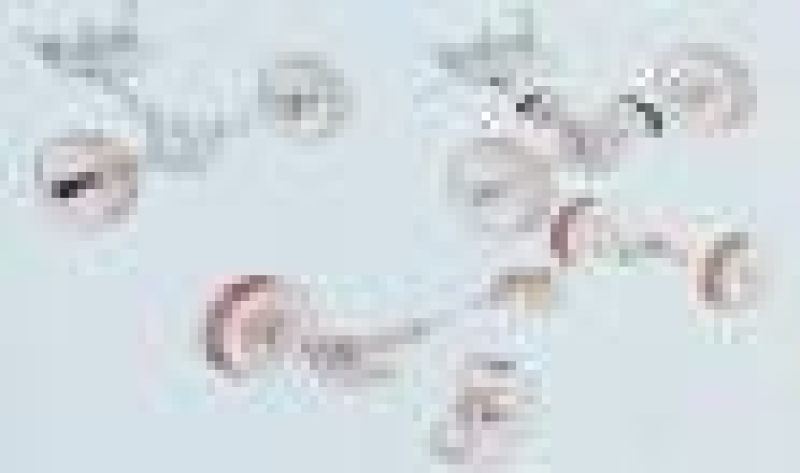 Manuelle AVM-Freilaufnaben SJ 410/413